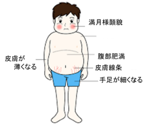 満月様顔貌や腹部肥満、皮膚線条、皮下出血、手足が細くなるなどの身体的特徴が現れる